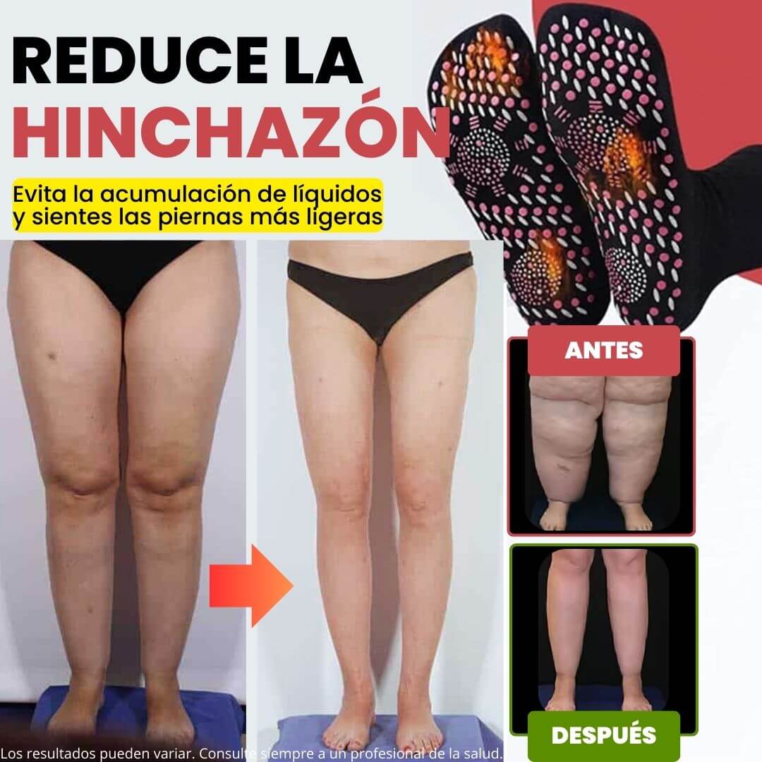 Calcetines de acupresión Anti-Varices
